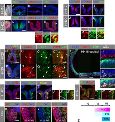 SHH and Notch regulate SOX9+ progenitors to govern arcuate POMC neurogenesis